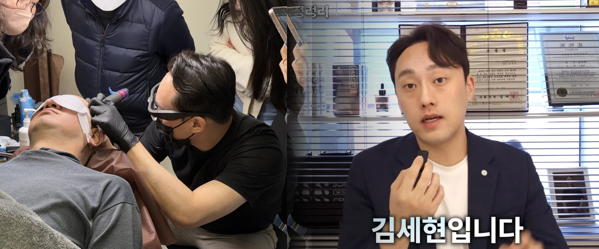 모노피그먼트 두피문신 시술 관련 정보