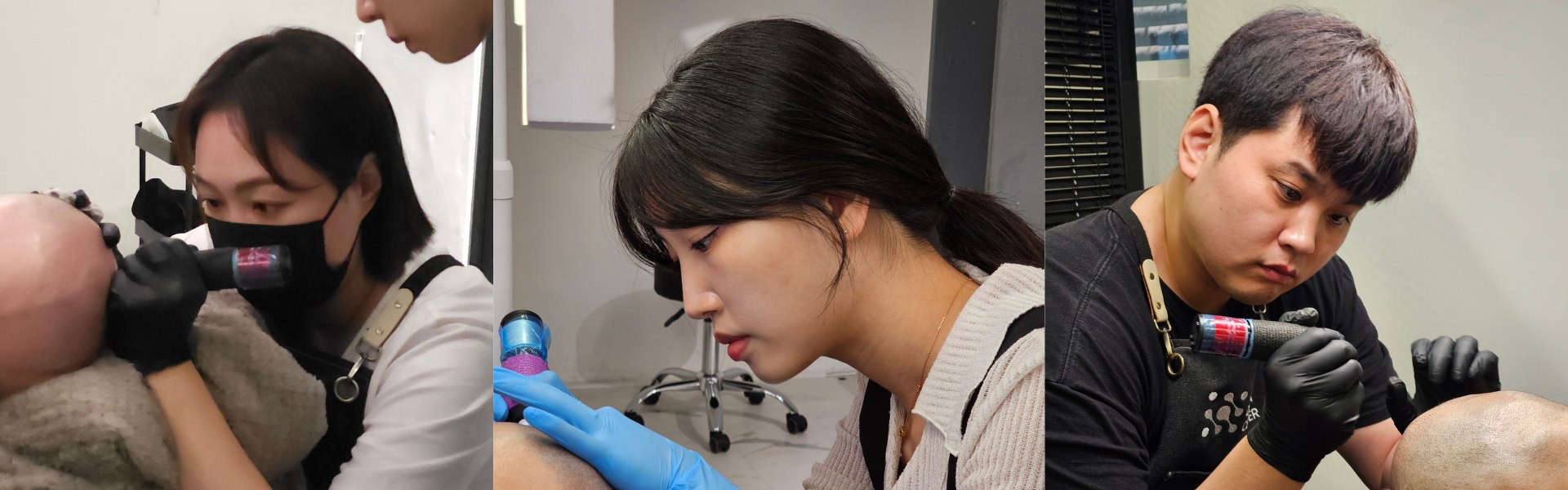 모노피그먼트 시술 기술
